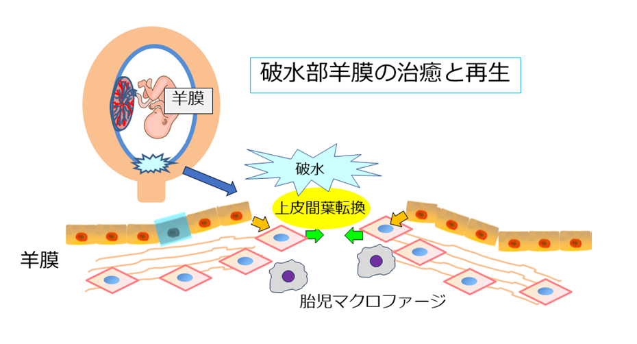 破水部羊膜の治癒と再生