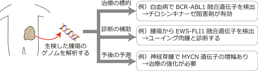 「ゲノム医療」説明図