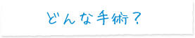 どんな手術？