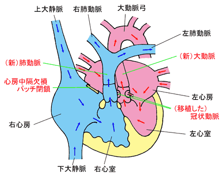 手術後の画像