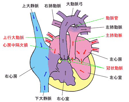 手術前の画像