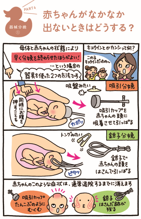 器械分娩の漫画