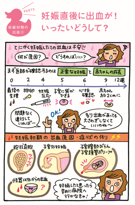 妊娠直後の出血の漫画