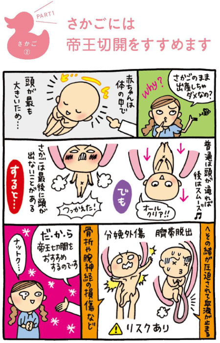 逆子の漫画