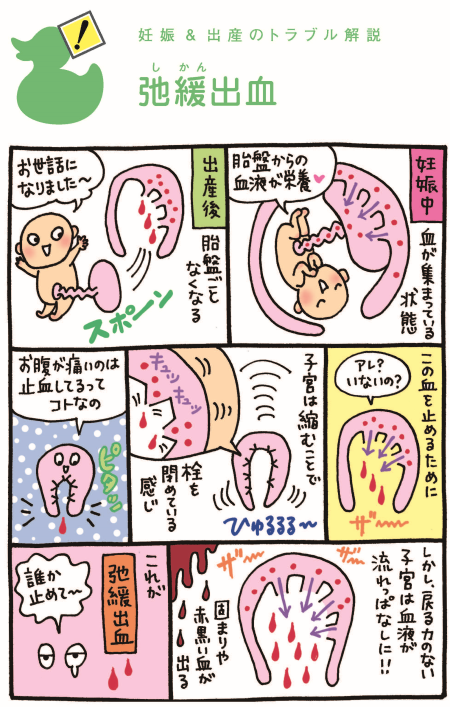 弛緩出血の漫画