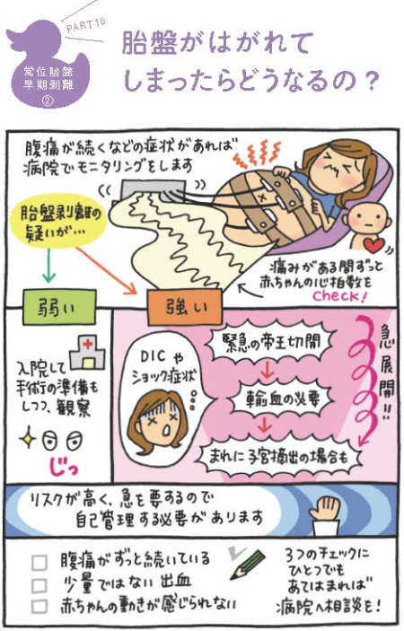 常位胎盤早期剥離の手術の漫画