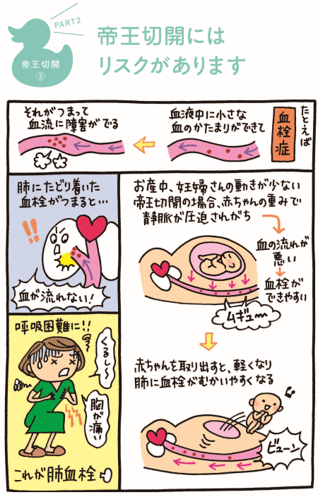 帝王切開の漫画