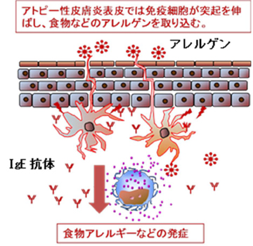 topic141001-1_2の画像