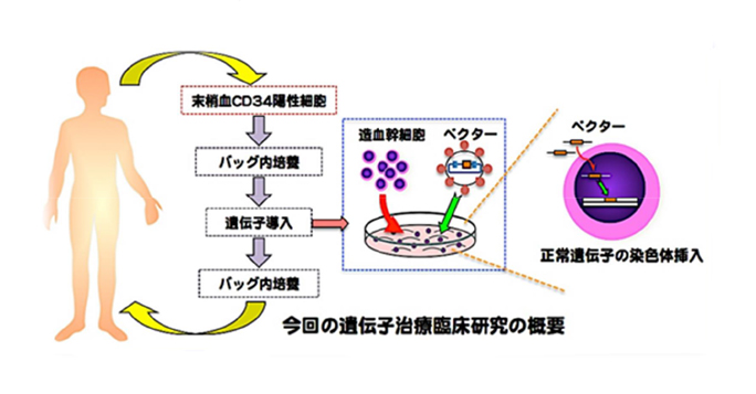 今回の遺伝子治療臨床研究の概要の画像