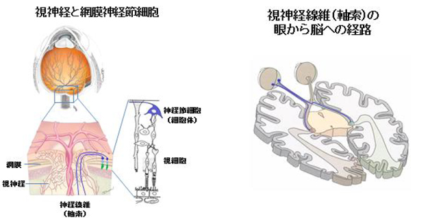 視神経と網膜神経節細胞、視神経線維（軸索）の眼から脳への経路の画像