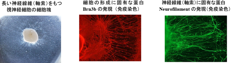 長い神経線維（軸索）をもつ視神経細胞の細胞塊、細胞の形成に固有な蛋白Brn3bの発現（免疫染色）、神経線維（軸索）に固有な蛋白Neurofilamentの発現（免疫染色）の画像