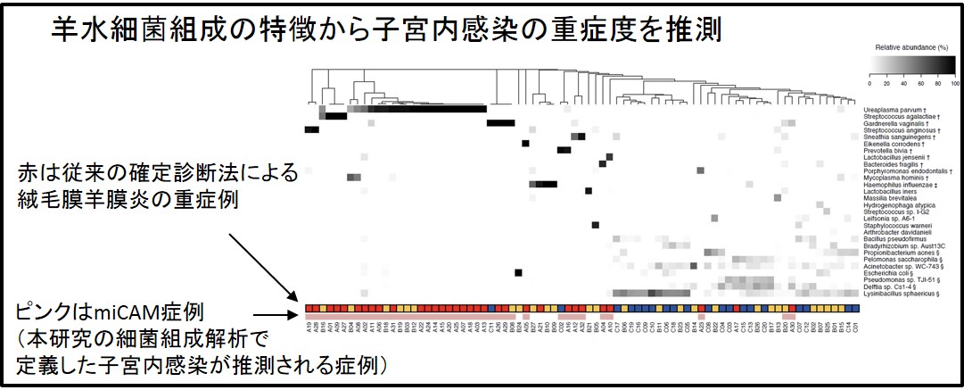 子宮内感染の重症度の画像