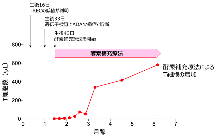 ADA欠損症の新生児への酵素補充療法の適用によるT細胞数の変化