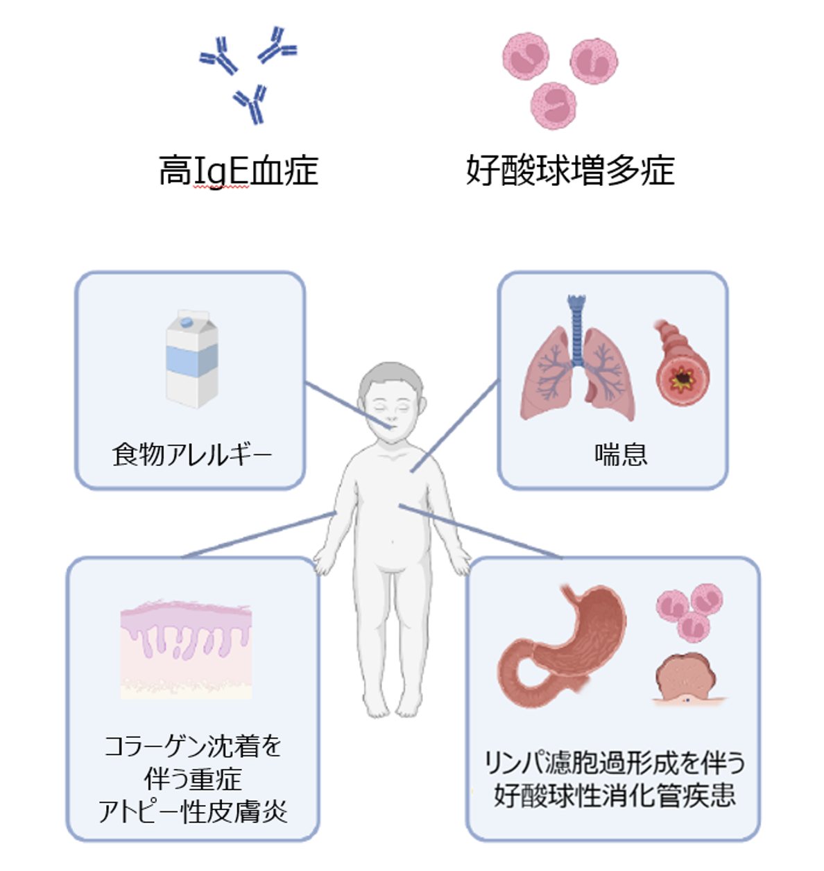 本研究で対象となった多様なアレルギー症状を有する男児のイメージ