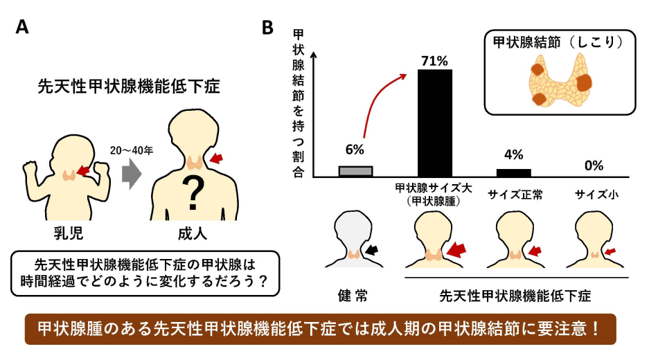 先天性甲状腺機能低下症の患者で、甲状腺結節をもつ割合のグラフ