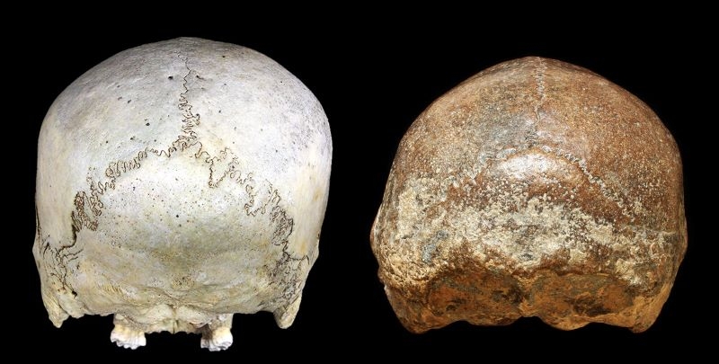 強い横方向の変形性斜頭を示す近世人骨(沖縄県新城遺跡)(左)とジャワ原人(中央・右)の頭骨